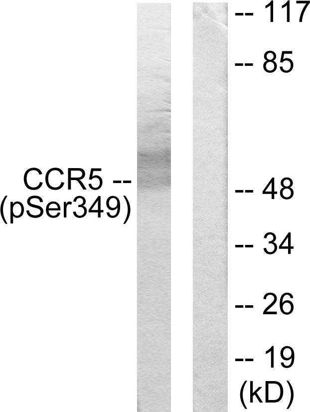 CCR5 Antibody - Western blot analysis of lysates from RAW264.7 cells treated with PMA 125ng/ml 30', using CCR5 (Phospho-Ser349) Antibody. The lane on the right is blocked with the phospho peptide.