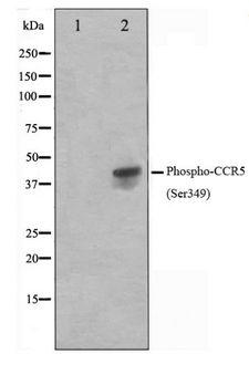 CCR5 Antibody - Western blot of Jurkat cell lysate using Phospho-CCR5(Ser349) Antibody