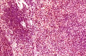CCR6 Antibody - Immunohistochemistry of paraffin-embeddedi mouse spleen stained with Goat anti-Human CD196, at a dilution of 1:125.