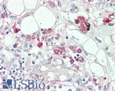 CCR6 Antibody - Human Thymus: Formalin-Fixed, Paraffin-Embedded (FFPE), at a concentration of 5 ug/ml. 