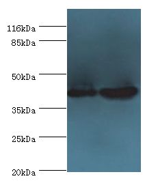 CCR6 Antibody - Western blot. All lanes: CCR6 antibody at 10 ug/ml. Lane 1: MCF-7 whole cell lysate Lane 2: HeLa whole cell lysate. Secondary antibody: goat polyclonal to rabbit at 1:10000 dilution. Predicted band size: 42 kDa. Observed band size: 42 kDa.  This image was taken for the unconjugated form of this product. Other forms have not been tested.
