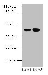 CCR6 Antibody - Western blot All lanes: CCR6 antibody at 10µg/ml Lane 1: MCF-7 whole cell lysate Lane 2: Hela whole cell lysate Secondary Goat polyclonal to rabbit IgG at 1/10000 dilution Predicted band size: 42 kDa Observed band size: 42 kDa