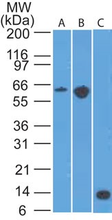 CCR6 Antibody - Western Blot: CCR6 Antibody (18B9E6) - analysis of A) mouse EL4, B) conA treated EL4 lysate and C) partial recombinant protein using CD196 (CCR6) antibody at 2 ug/ml.