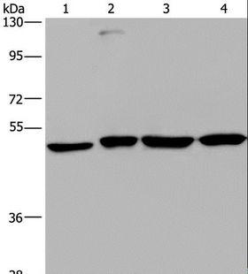 CCR6 Antibody - Western blot analysis of A431, HepG2, Raji and K562 cell, using CCR6 Polyclonal Antibody at dilution of 1:966.