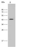 CCR6 Antibody - Anti-CCR6 rabbit polyclonal antibody at 1:500 dilution. Lane A: Mouse spleen tissue lysate. Lysates/proteins at 30 ug per lane. Secondary: Goat Anti-Rabbit IgG (H+L)/HRP at 1/10000 dilution. Developed using the ECL technique. Performed under reducing conditions. Predicted band size: 42 kDa.