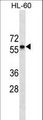 CCR7 Antibody - CCR7 Antibody (Ascites)western blot of HL-60 cell line lysates (35 ug/lane). The CCR7 antibody detected the CCR7 protein (arrow).
