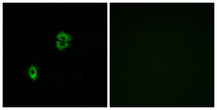 CCR7 Antibody - Immunofluorescence analysis of A549 cells, using CCR7 Antibody. The picture on the right is blocked with the synthesized peptide.