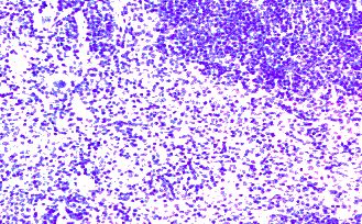 CCR7 Antibody - Immunohistochemistry of paraffin-embeddedi mouse spleen stained with Goat anti-mouse CD197