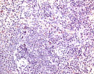 CCR7 Antibody - Immunohistochemistry of paraffin-embeddedi human spleen stained with Goat anti-mouse CD197