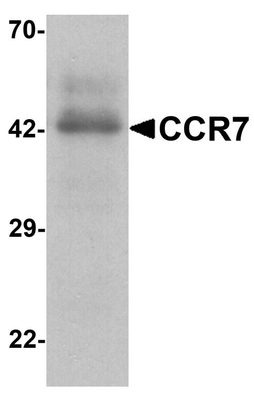 CCR7 Antibody - Western blot analysis of CCR7 in human spleen tissue lysate with CCR7 antibody at 1 ug/ml.