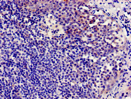 CCR7 Antibody - Immunocytochemistry analysis of human tonsil tissue at a dilution of 1:100