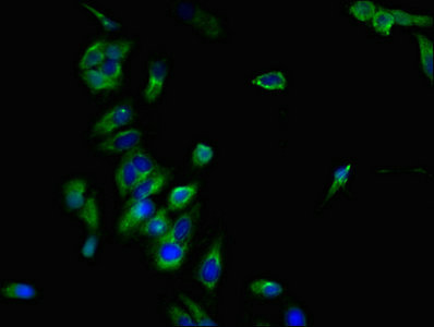 CCR7 Antibody - Immunofluorescent analysis of Hela cells at a dilution of 1:100 and Alexa Fluor 488-congugated AffiniPure Goat Anti-Rabbit IgG(H+L)