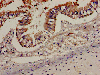 CCR7 Antibody - Immunohistochemistry analysis of human lung tissue at a dilution of 1:100