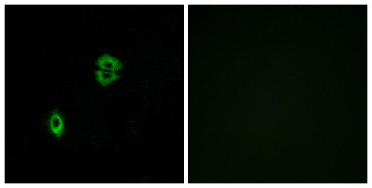 CCR7 Antibody - Peptide - + Immunofluorescence analysis of A549 cells, using CCR7 antibody.