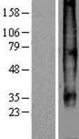 CCR7 Protein - Western validation with an anti-DDK antibody * L: Control HEK293 lysate R: Over-expression lysate