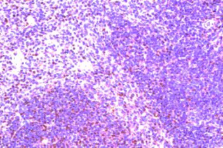 CCR8 / CD198 Antibody - Immunohistochemistry of paraffin-embedded mouse spleen with Goat anti-mouse CDw198