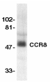 CCR8 / CD198 Antibody - Western blot of CCR8 in human spleen lysate with CCR8 antibody at 1:500 dilution.