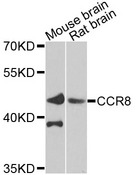 CCR8 / CD198 Antibody - Western blot analysis of extracts of various cells.