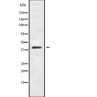 CCR8 / CD198 Antibody - Western blot analysis of CCR8 using COLO205 whole cells lysates