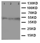 CCR9 / CD199 Antibody - WB of CCR9 antibody. Lane 1: JURKAT Cell Lysate. Lane 2: HELA Cell Lysate. Lane 3: SMMC Cell Lysate.