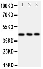 CCR9 / CD199 Antibody - Anti-CCR9 antibody, Western blotting All lanes: Anti CCR9 at 0.5ug/ml Lane 1: JURKAT Whole Cell Lysate at 40ug Lane 2: HELA Whole Cell Lysate at 40ug Lane 3: SMMC Whole Cell Lysate at 40ug Predicted bind size: 42KD Observed bind size: 42KD