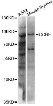 CCR9 / CD199 Antibody - Western blot analysis of extracts of various cell lines, using CCR9 antibody at 1:1000 dilution. The secondary antibody used was an HRP Goat Anti-Rabbit IgG (H+L) at 1:10000 dilution. Lysates were loaded 25ug per lane and 3% nonfat dry milk in TBST was used for blocking. An ECL Kit was used for detection and the exposure time was 30s.