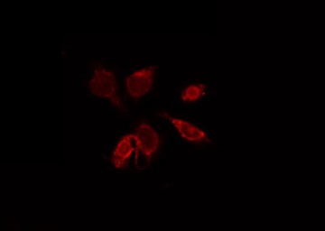 CCR9 / CD199 Antibody - Staining HepG2 cells by IF/ICC. The samples were fixed with PFA and permeabilized in 0.1% Triton X-100, then blocked in 10% serum for 45 min at 25°C. The primary antibody was diluted at 1:200 and incubated with the sample for 1 hour at 37°C. An Alexa Fluor 594 conjugated goat anti-rabbit IgG (H+L) Ab, diluted at 1/600, was used as the secondary antibody.