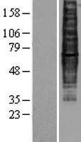 CCR9 / CD199 Protein - Western validation with an anti-DDK antibody * L: Control HEK293 lysate R: Over-expression lysate