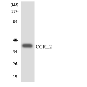 CCRL2 Antibody - Western blot analysis of the lysates from 293 cells using CCRL2 antibody.