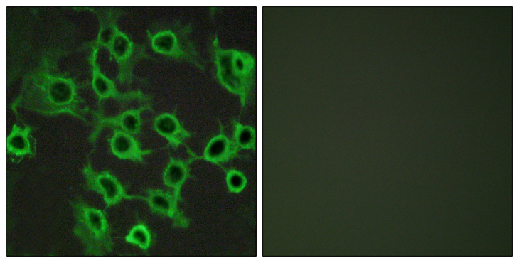 CCRL2 Antibody - Immunofluorescence analysis of COS7 cells, using CCRL2 Antibody. The picture on the right is blocked with the synthesized peptide.