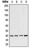 CCRL2 Antibody - Western blot analysis of CCRL2 expression in HeLa (A); mouse heart (B); mouse brain (C); rat brain (D) whole cell lysates.