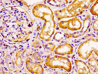 CCRL2 Antibody - Immunohistochemistry image of paraffin-embedded human kidney tissue at a dilution of 1:100