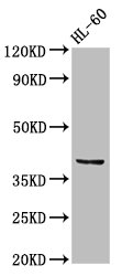 CCRL2 Antibody - Positive Western Blot detected in HL60 whole cell lysate. All lanes: CCRL2 antibody at 2.5 µg/ml Secondary Goat polyclonal to rabbit IgG at 1/50000 dilution. Predicted band size: 40, 41 KDa. Observed band size: 40 KDa