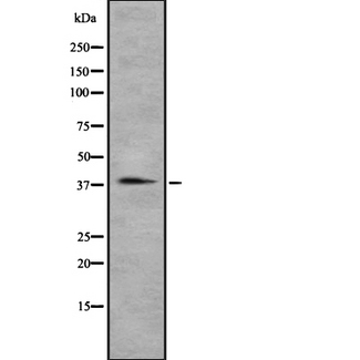 CCRL2 Antibody - Western blot analysis of CCRL2 using A549 whole cells lysates