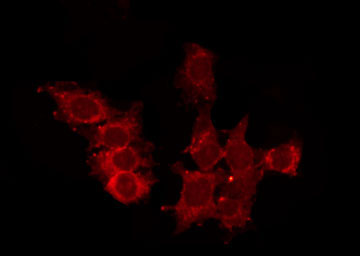 CCRL2 Antibody - Staining HepG2 cells by IF/ICC. The samples were fixed with PFA and permeabilized in 0.1% Triton X-100, then blocked in 10% serum for 45 min at 25°C. The primary antibody was diluted at 1:200 and incubated with the sample for 1 hour at 37°C. An Alexa Fluor 594 conjugated goat anti-rabbit IgG (H+L) Ab, diluted at 1/600, was used as the secondary antibody.