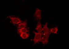 CCRL2 Antibody - Staining HepG2 cells by IF/ICC. The samples were fixed with PFA and permeabilized in 0.1% Triton X-100, then blocked in 10% serum for 45 min at 25°C. The primary antibody was diluted at 1:200 and incubated with the sample for 1 hour at 37°C. An Alexa Fluor 594 conjugated goat anti-rabbit IgG (H+L) Ab, diluted at 1/600, was used as the secondary antibody.