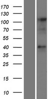CCRL2 Protein - Western validation with an anti-DDK antibody * L: Control HEK293 lysate R: Over-expression lysate