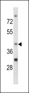 CCRN4L / Nocturnin Antibody - Western blot of CCRN4L antibody in K562 cell line lysates (35 ug/lane). CCRN4L (arrow) was detected using the purified antibody.