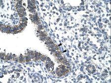 CCRN4L / Nocturnin Antibody - CCRN4L antibody ARP32536_T100-NP_036250-CCRN4L (CCR4 carbon catabolite repression 4-like (S. cerevisiae)) Antibody was used in IHC to stain formalin-fixed, paraffin-embedded human lung.  This image was taken for the unconjugated form of this product. Other forms have not been tested.