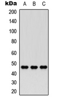 CCRN4L / Nocturnin Antibody - Western blot analysis of Nocturnin expression in HEK293T (A); PC12 (B); HeLa (C) whole cell lysates.
