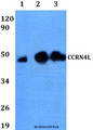 CCRN4L / Nocturnin Antibody - Western blot of CCRN4L antibody at 1:500 dilution. Lane 1: HEK293T whole cell lysate. Lane 2: PC12 whole cell lysate. Lane 3: HeLa whole cell lysate.