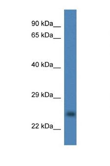 CCS Antibody - CCS antibody Western blot of Fetal Liver lysate. Antibody concentration 1 ug/ml.  This image was taken for the unconjugated form of this product. Other forms have not been tested.