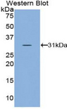 CCS Antibody - Western blot of recombinant CCS.  This image was taken for the unconjugated form of this product. Other forms have not been tested.