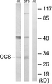 CCS Antibody - Western blot analysis of lysates from NIH/3T3 and Jurkat cells, using CCS Antibody. The lane on the right is blocked with the synthesized peptide.