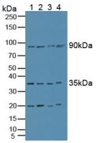 CCS Antibody - Western Blot; Sample: Lane1: Human Lung Tissue; Lane2: Human HepG2 Cells; Lane3: Human Hela Cells; Lane4: Human Jurkat Cells.