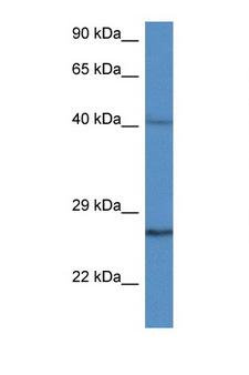 CCS Antibody - CCS antibody Western blot of 435S Cell lysate. Antibody concentration 1 ug/ml.  This image was taken for the unconjugated form of this product. Other forms have not been tested.