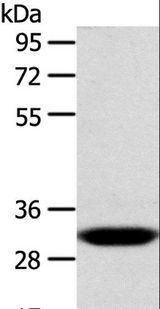 CCS Antibody - Western blot analysis of Human fetal liver tissue, using CCS Polyclonal Antibody at dilution of 1:300.