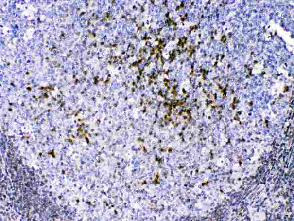 CCS Antibody - CCS was detected in paraffin-embedded sections of human tonsil tissues using rabbit anti- CCS Antigen Affinity purified polyclonal antibody