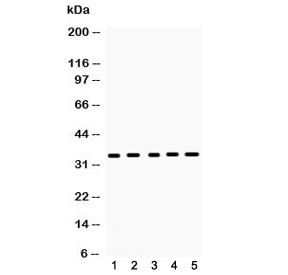 CCS Antibody - Western blot testing of 1) rat brain, 2) rat spleen, 3) mouse brain, 4) mouse spleen and 5) human 293T lysate with CCS antibody at 0.5ug/ml. Predicted molecular weight ~34 kDa.