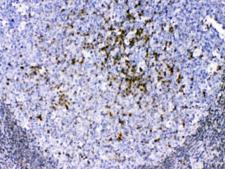 CCS Antibody - IHC testing of FFPE human tonsil tissue with CCS antibody a 1ug/ml. Required HIER: steam section in pH6 citrate buffer for 20 min and allow to cool prior to testing.